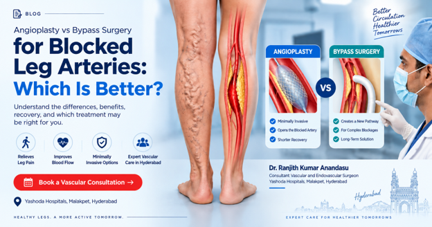 Angioplasty vs Bypass Surgery for Blocked Leg Arteries